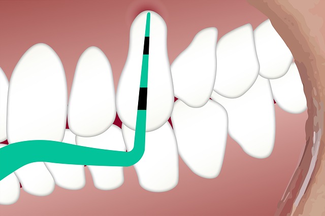 pinzeta zubního lékaře