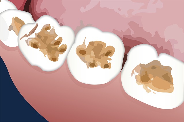 kazy v zubních ploškách